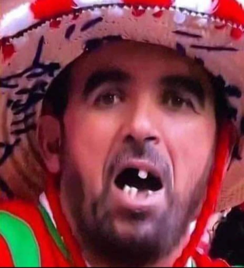مفاجأة مونديال قطر.. لن تصدق كيف أصبح حال مشجع مغربي تعرض للتنمر بسبب أسنانه.. ما حدث أمر لن يخطر على بالك(صورة)